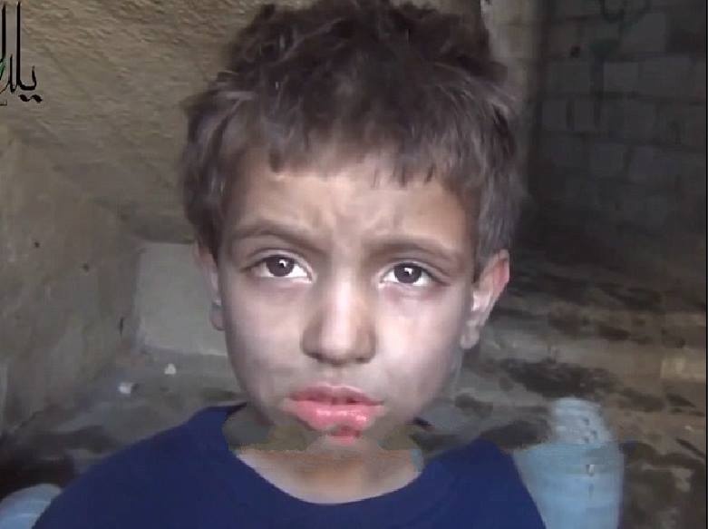 Be trai Syria phai an co de ton tai hinh anh