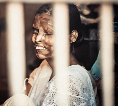 Ky uc kinh hoang cua nhung co gai bi tat axit o An Do hinh anh