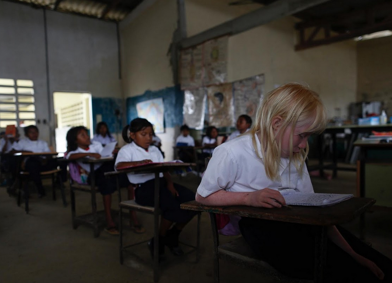 Yalsseth Morales, 11 tuổi, trong lớp học. Những trẻ bạch tạng vẫn học tập như các bạn bình thường khác. 