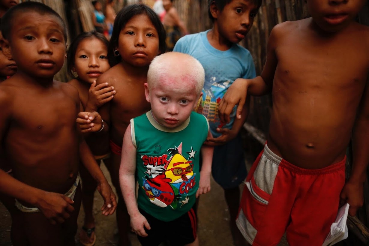 Cuoc song cua 'nhung dua con mat trang' hinh anh