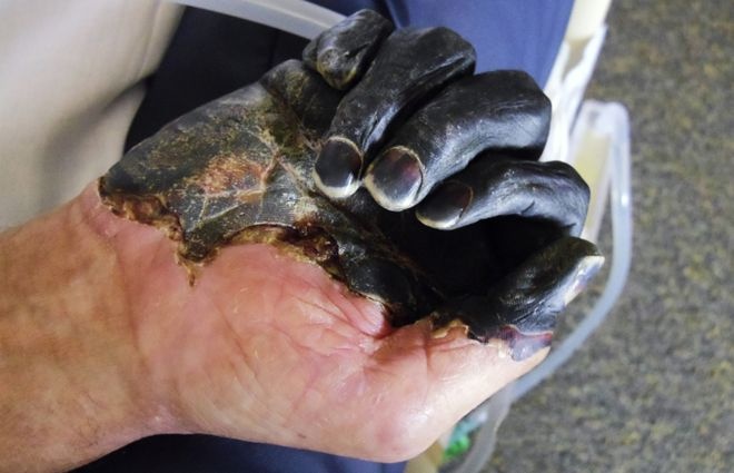 Vi sao My chua the xoa so Cai chet Den? hinh anh