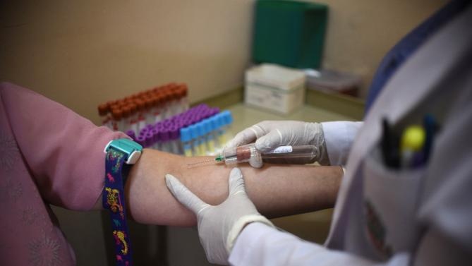 Virus Zika la thu pham gay nen hoi chung than kinh nguy hiem hinh anh