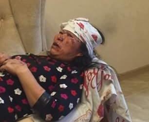 Vo chong nguoi Viet bi cuop danh trong thuong o Ukraine hinh anh