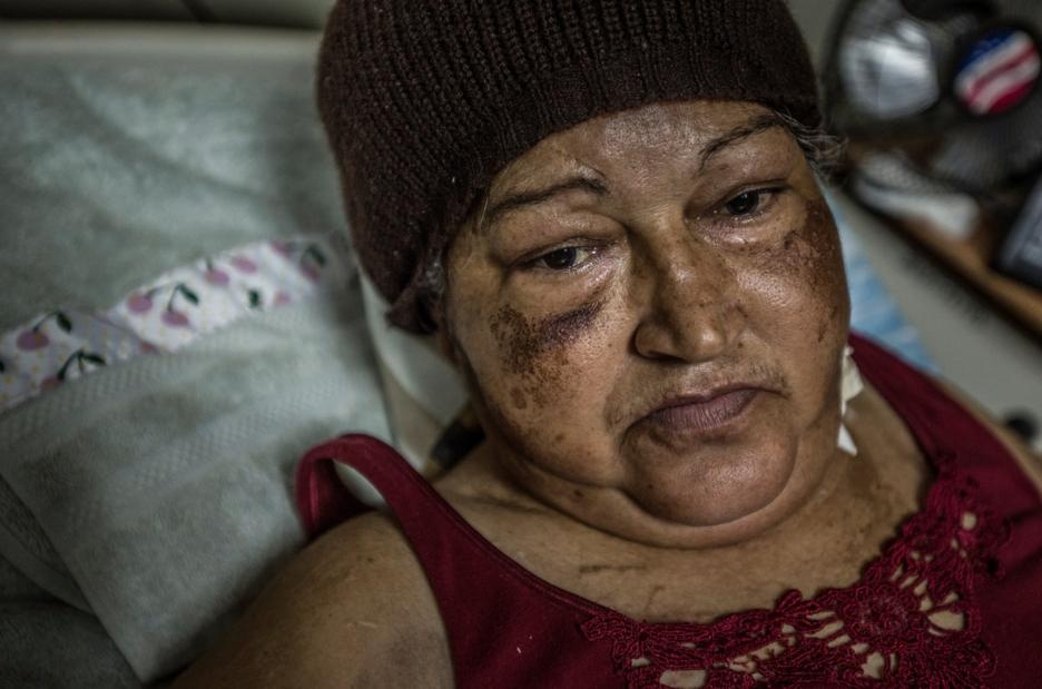 Benh vien Venezuela nhu trong the ky 19 anh 9