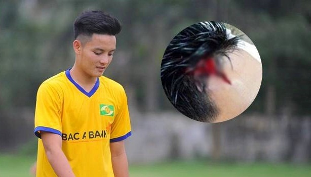 Trung ve SLNA xung phong ra san voi 15 mui khau tren dau hinh anh