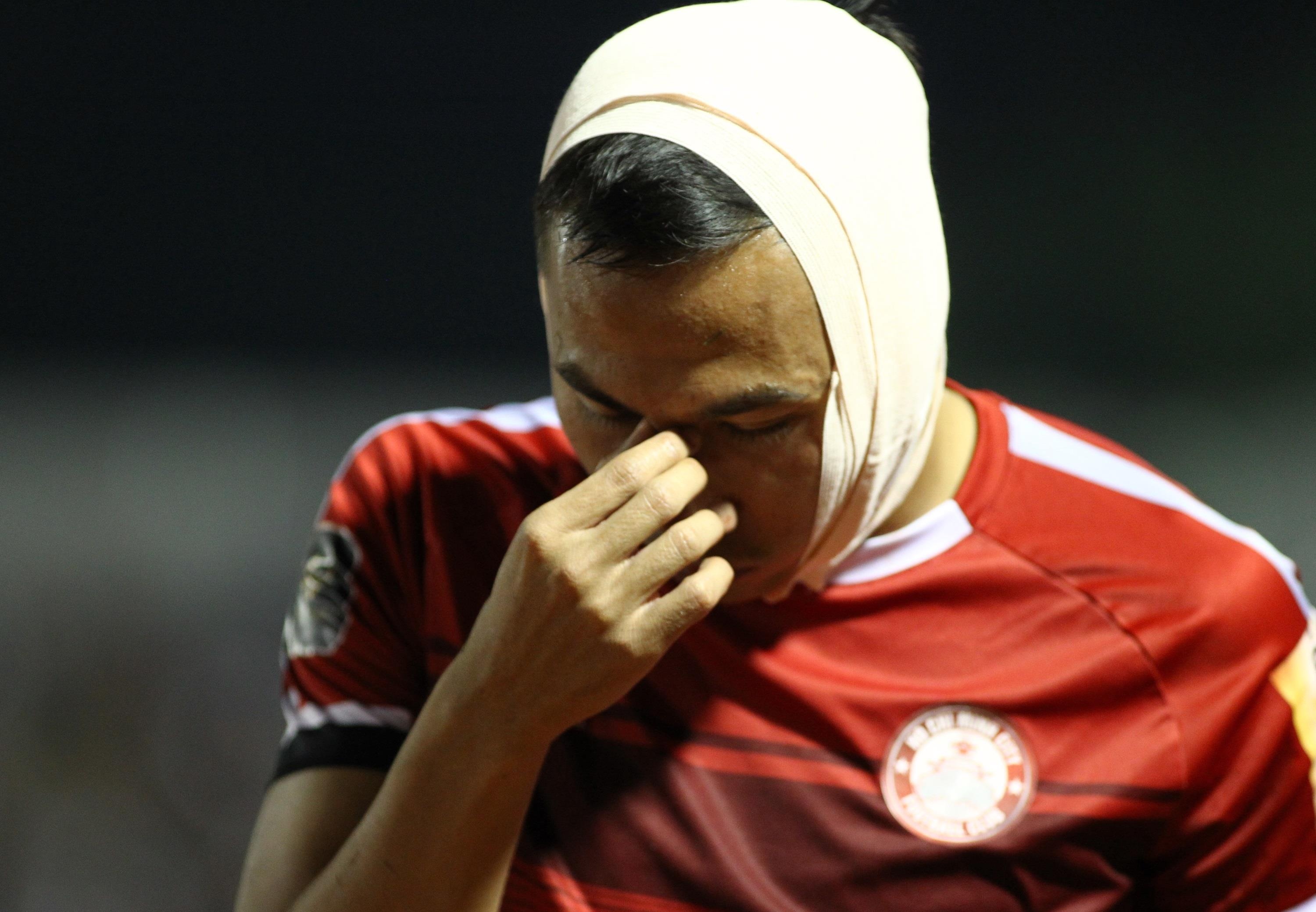 Tien dao CLB TP.HCM bi khau 3 mui o mang tai hinh anh