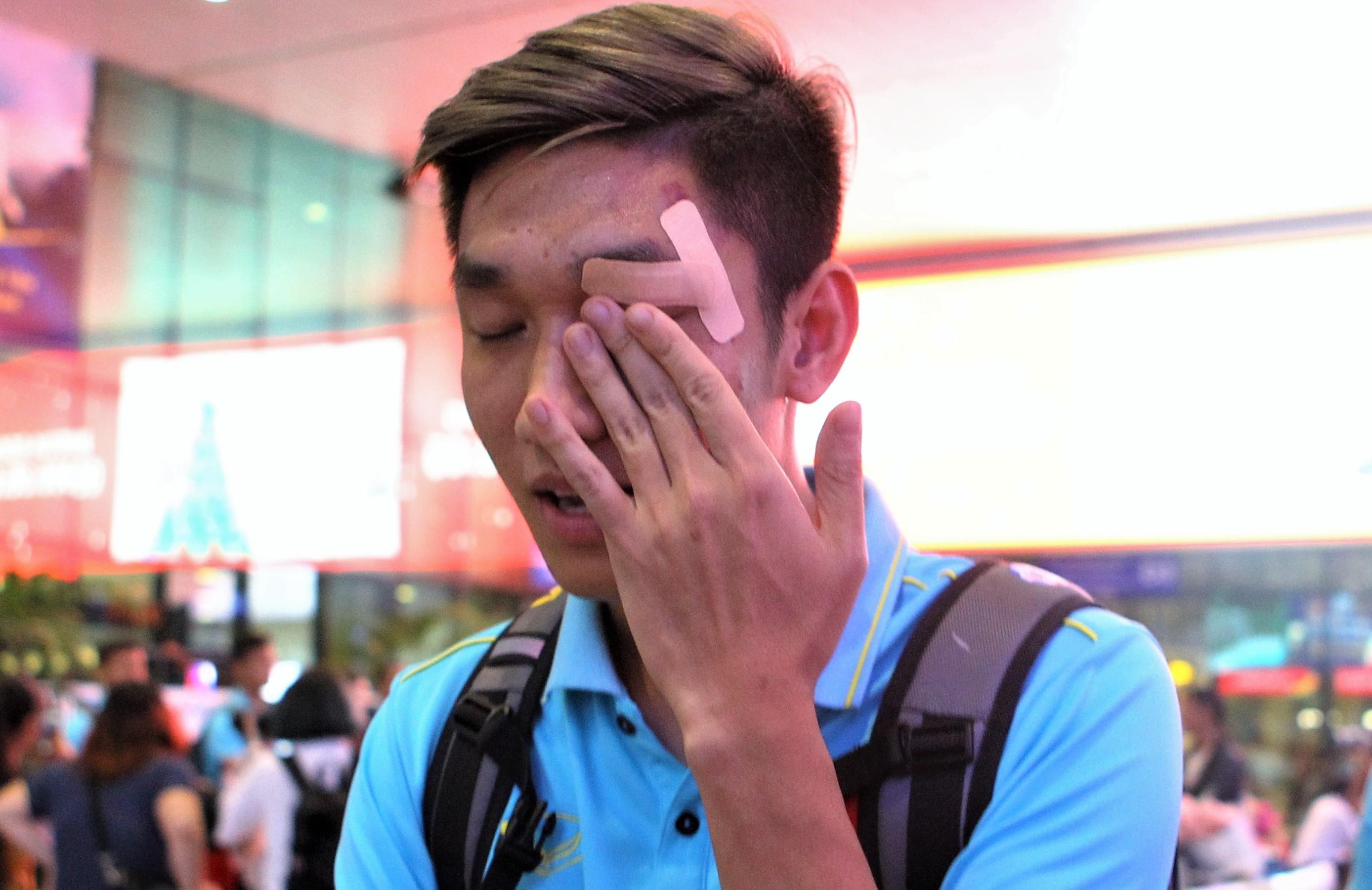 Trong Dai che mi mat bi rach khi vao TP.HCM cung U22 Viet Nam hinh anh