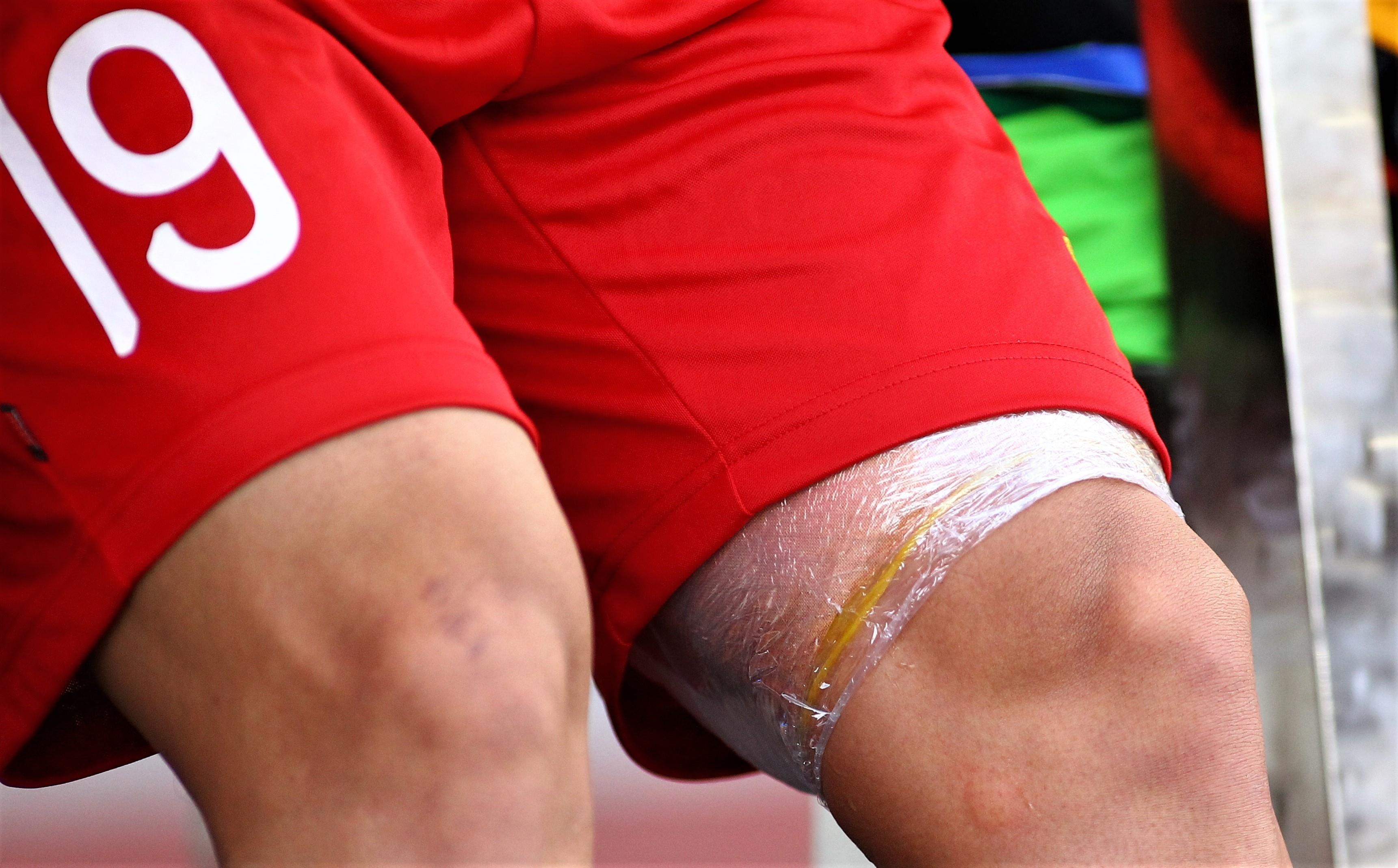 Quang Hai quan chat bang ben dui dinh chan thuong hinh anh