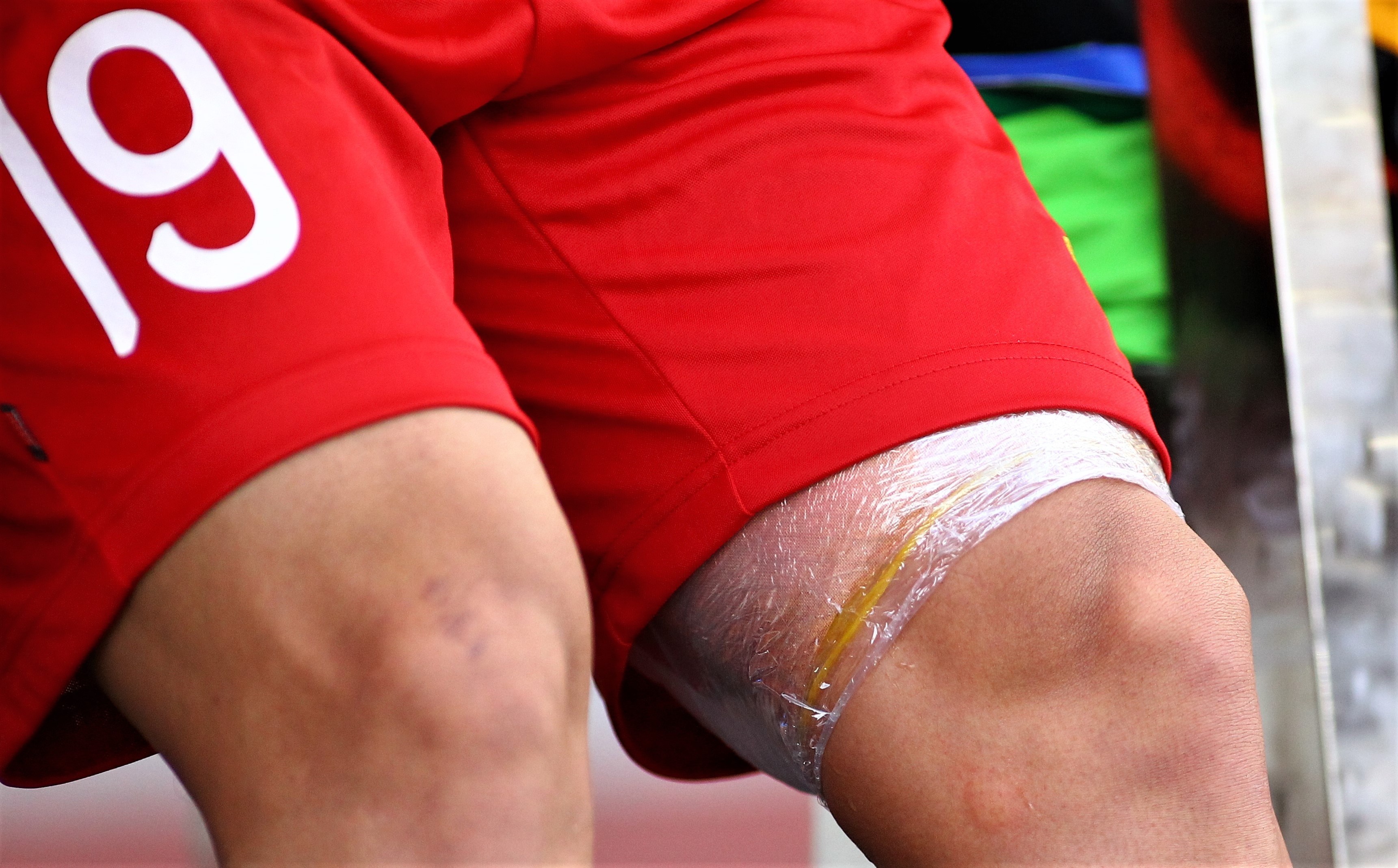 quang hải chấn thương ảnh 5 quang hai chan thuong anh 5