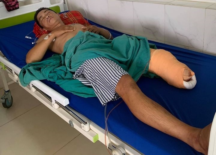 Cuu doi truong CLB Dak Lak phai cua chan vi tai nan giao thong hinh anh