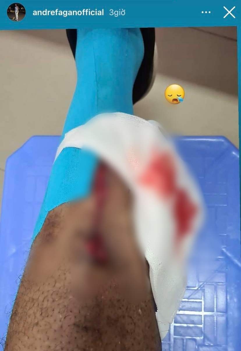 fagan khau 25 mui anh 1