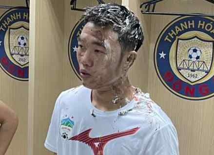 Xuan Truong bi up banh kem o san Thanh Hoa hinh anh