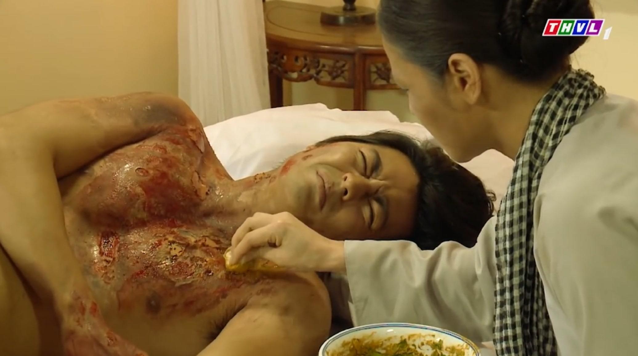 Thi Binh khoc khi nhin vet thuong lo loet cua con trai hinh anh