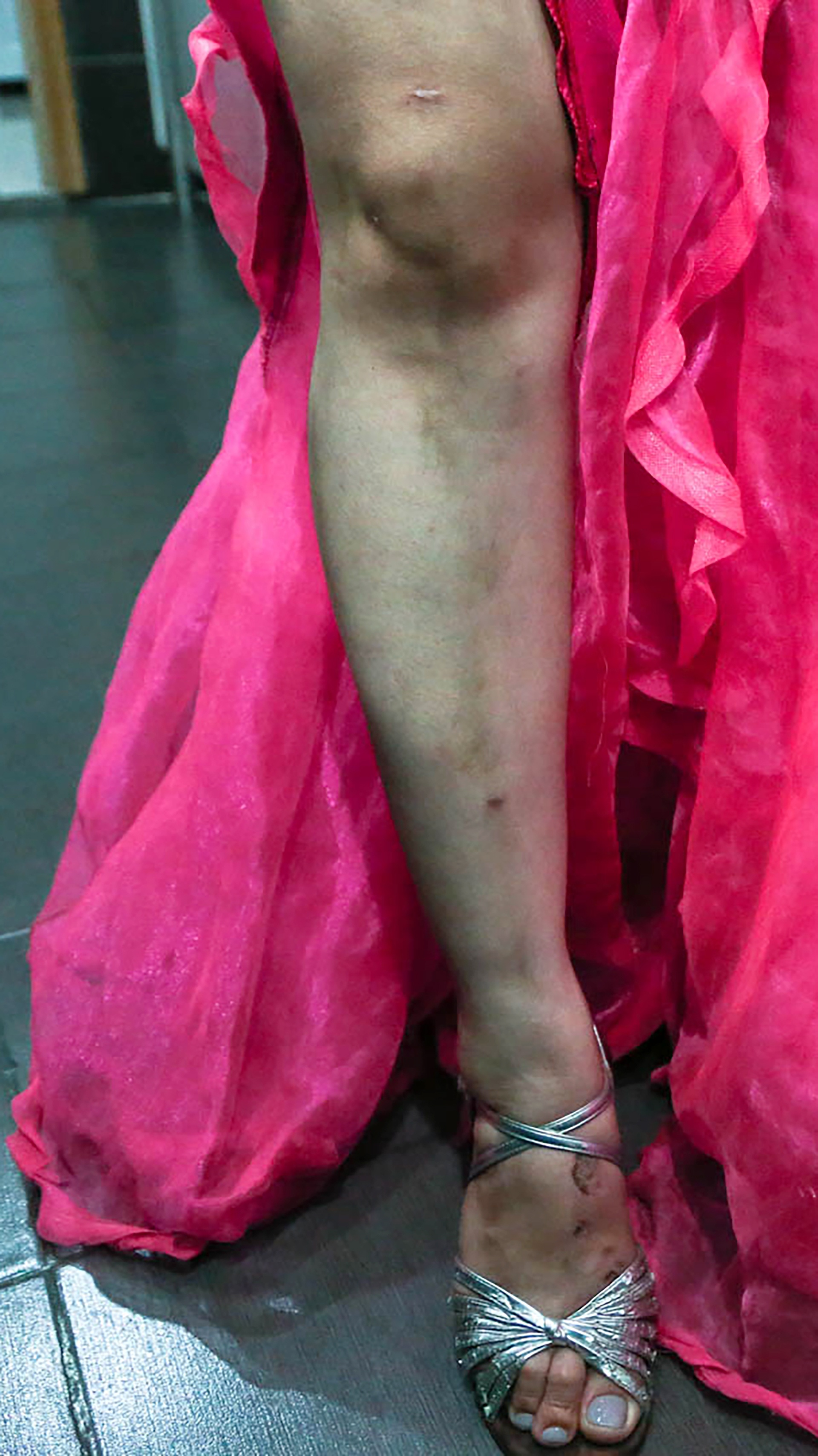 Nghệ sĩ múa lửa ảnh 32 Nghe si mua lua anh 32