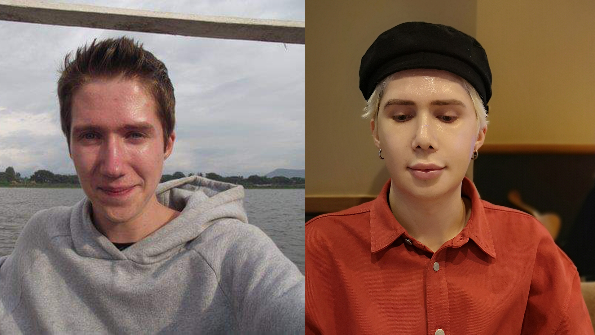 Chang trai Anh nhan la nguoi Han, phau thuat 18 lan de giong idol hinh anh