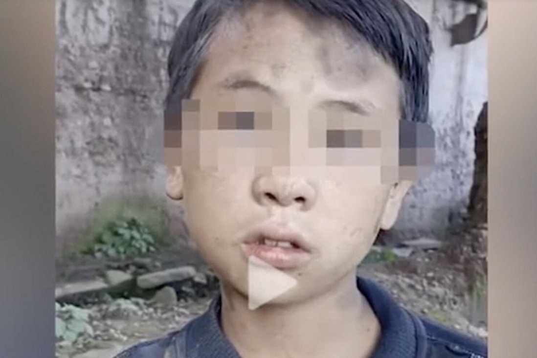 bắt trẻ em giả nghèo câu kéo lượt xem  ảnh 1 bat tre em gia ngheo cau keo luot xem anh 1