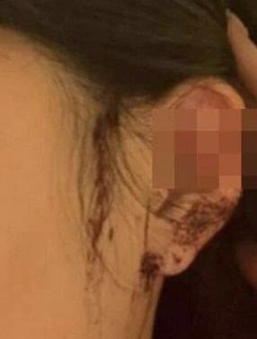 bi cat tai khi di hop dem anh 1