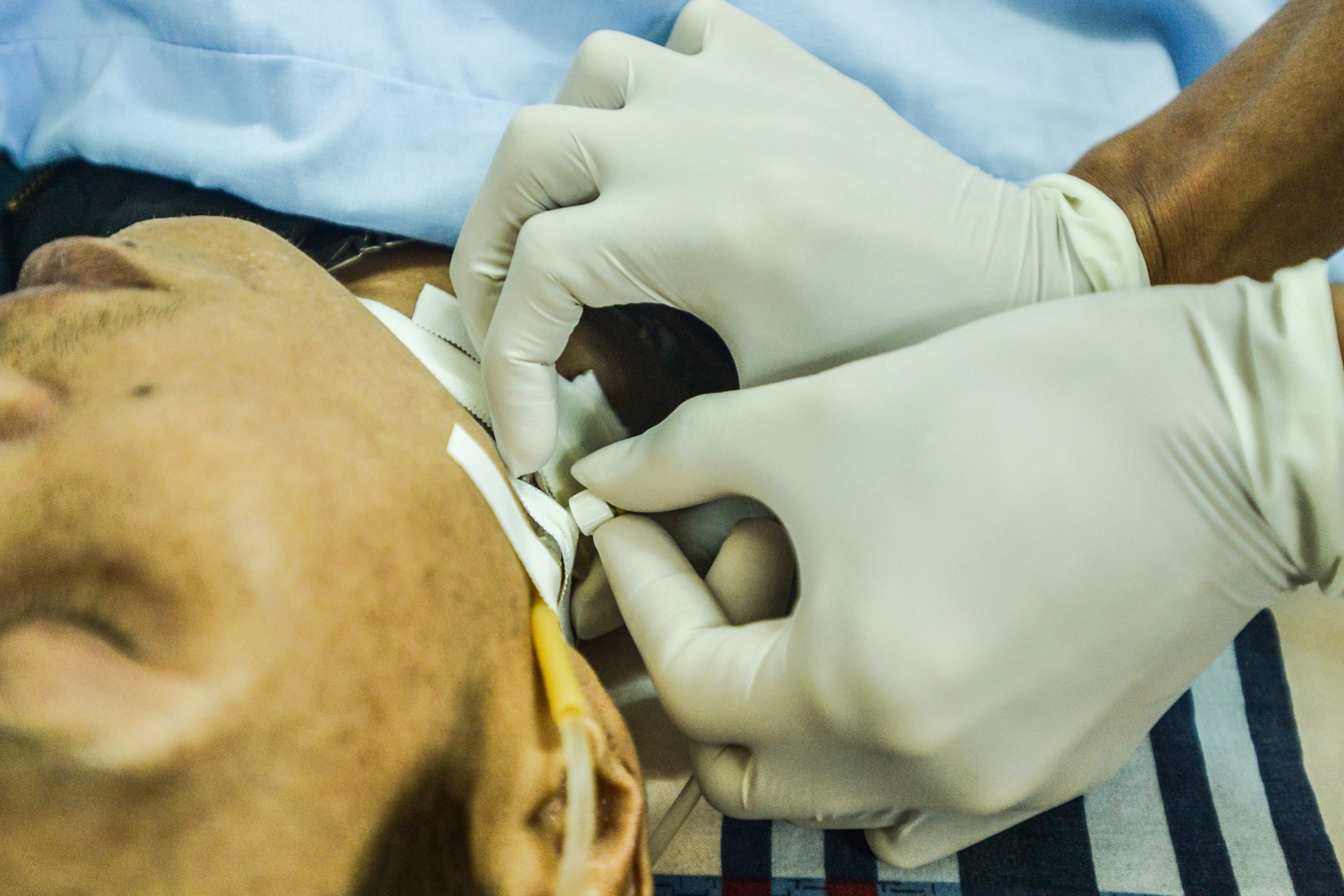 bệnh nhân nhiễm HIV ảnh 15 benh nhan nhiem HIV anh 15