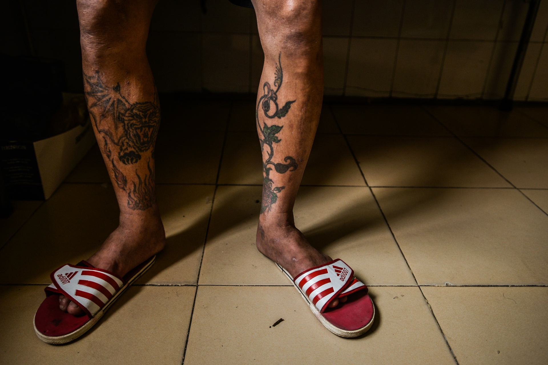 bệnh nhân nhiễm HIV ảnh 1 benh nhan nhiem HIV anh 1