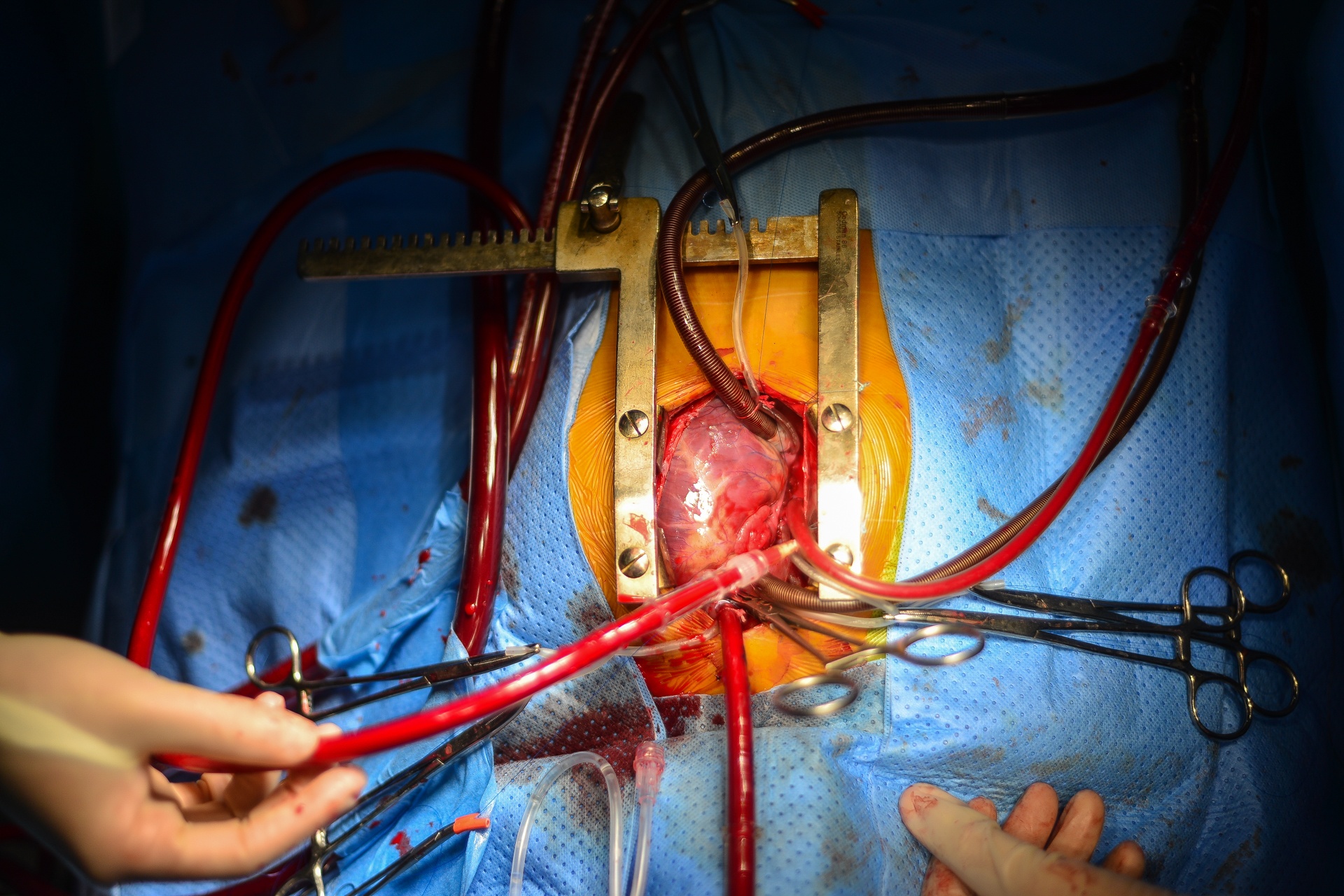 hanh tinh sua nhip trai tim anh 35