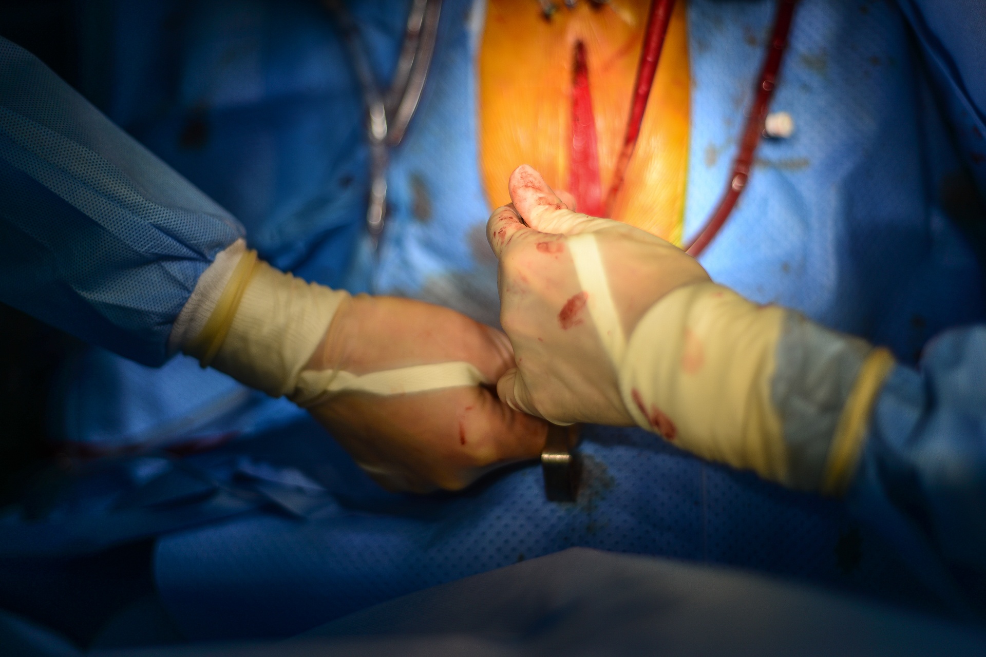 hanh tinh sua nhip trai tim anh 37