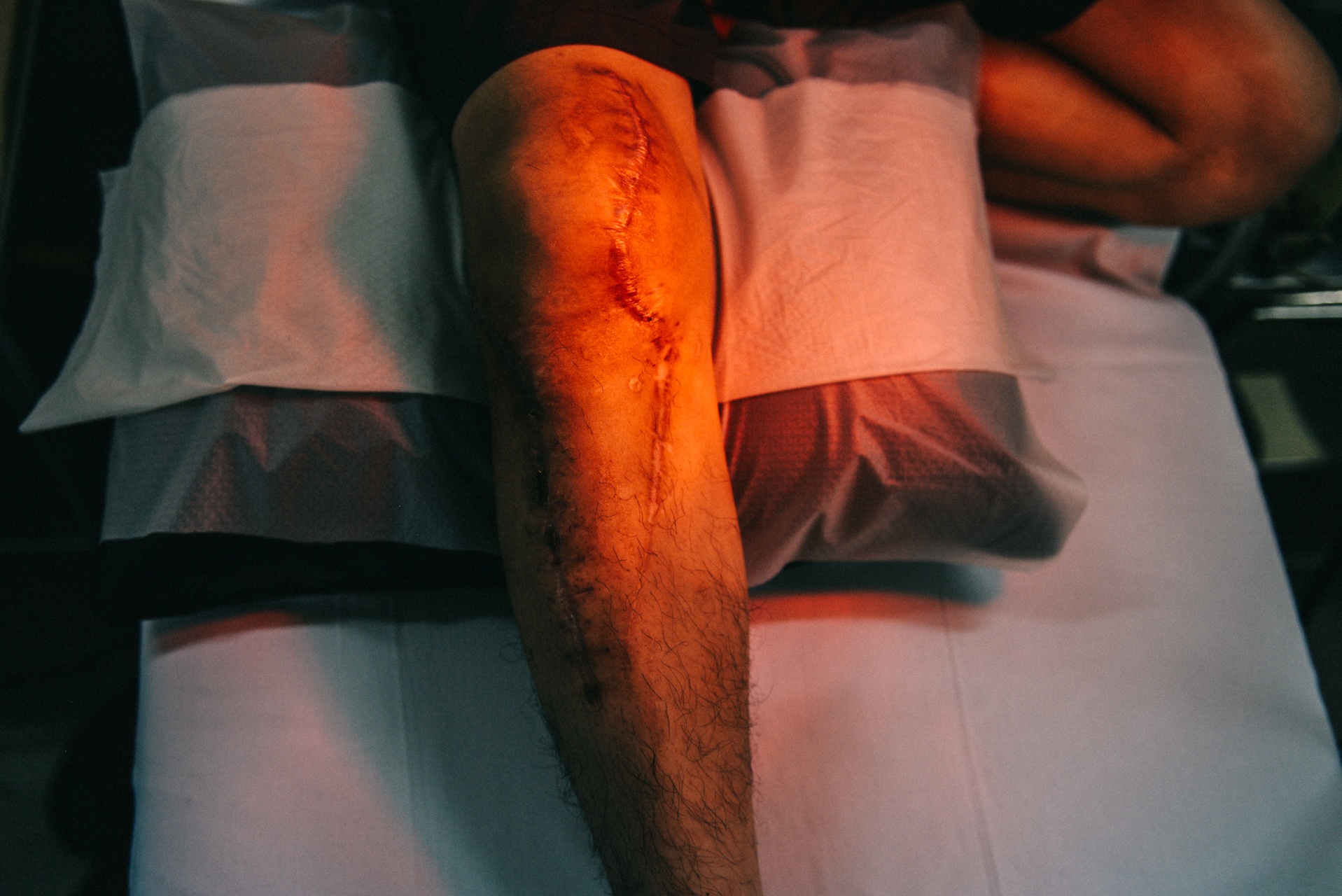 Số phận của những nạn nhân tai nạn giao thông ảnh 30 So phan cua nhung nan nhan tai nan giao thong anh 30