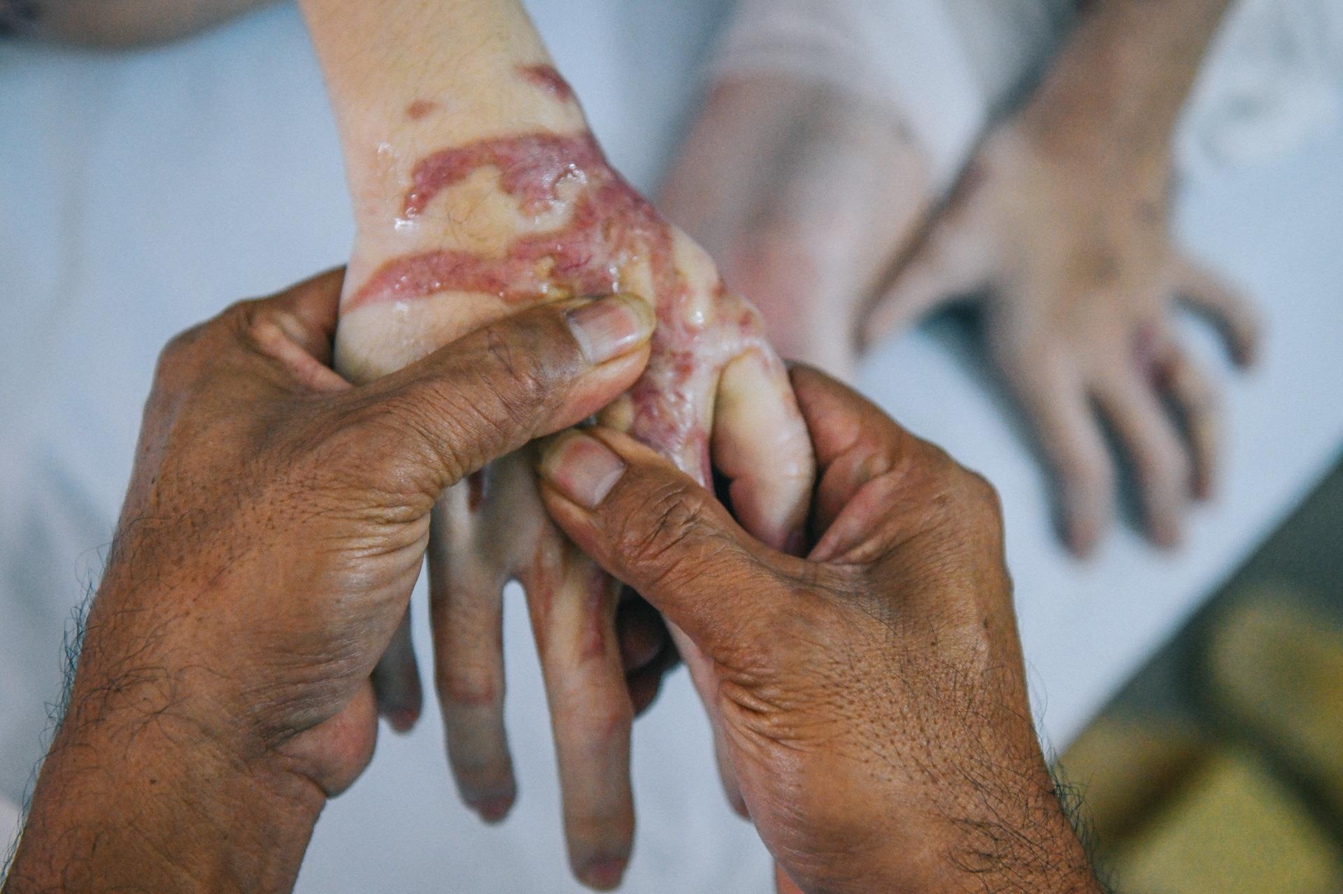 Nan nhan bi tat axit anh 16