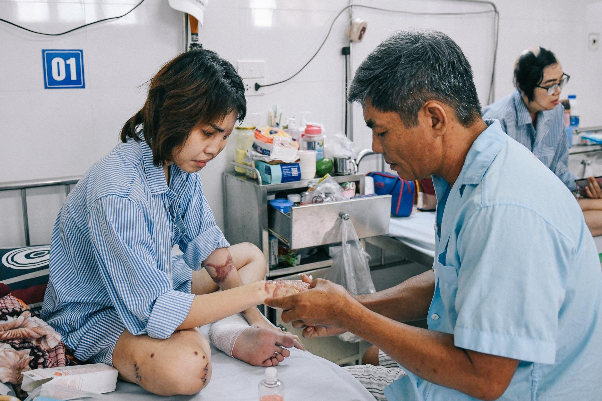 Nan nhan bi tat axit anh 15