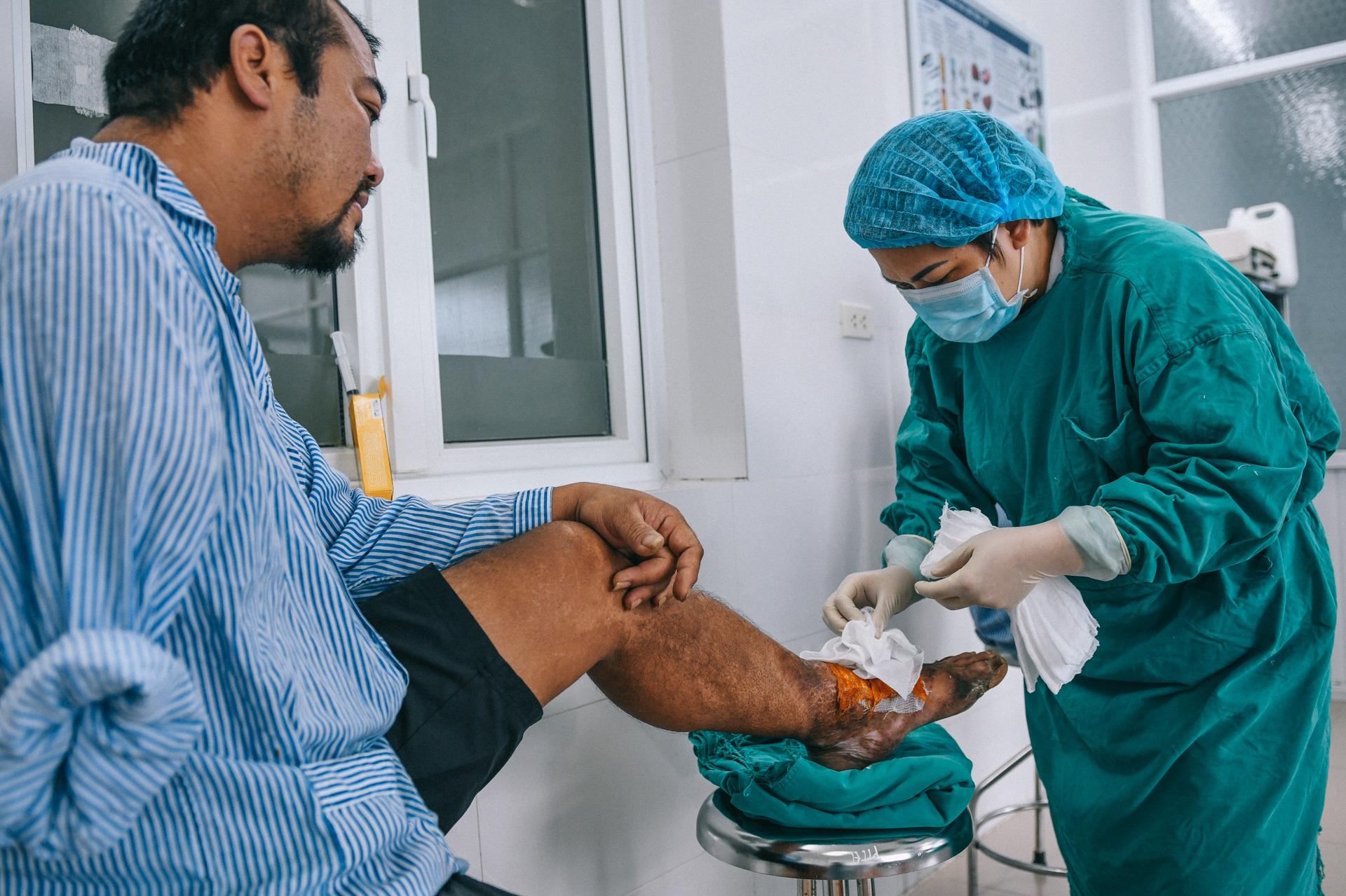 Nan nhan bi tat axit anh 28