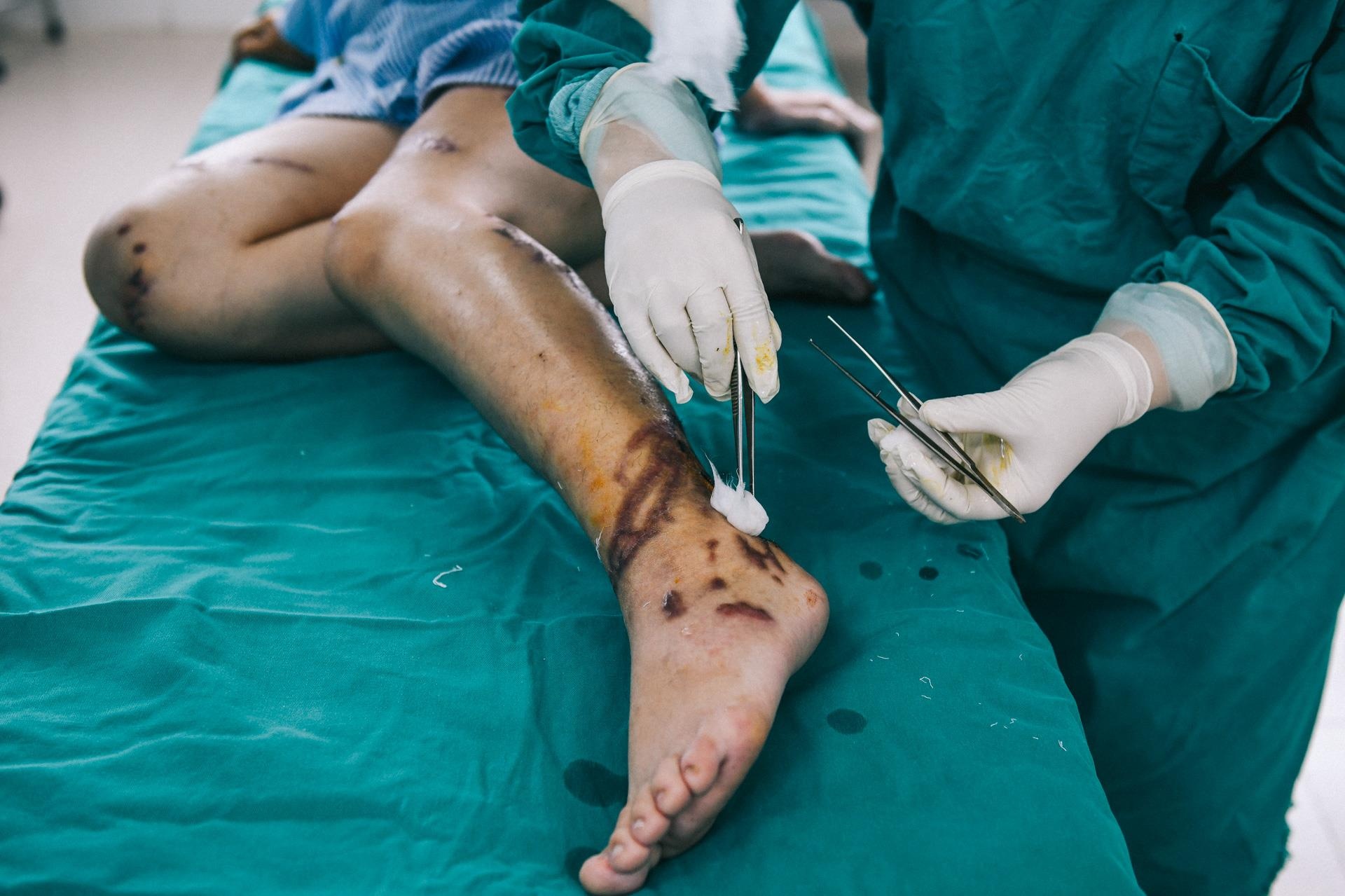 Nan nhan bi tat axit anh 30