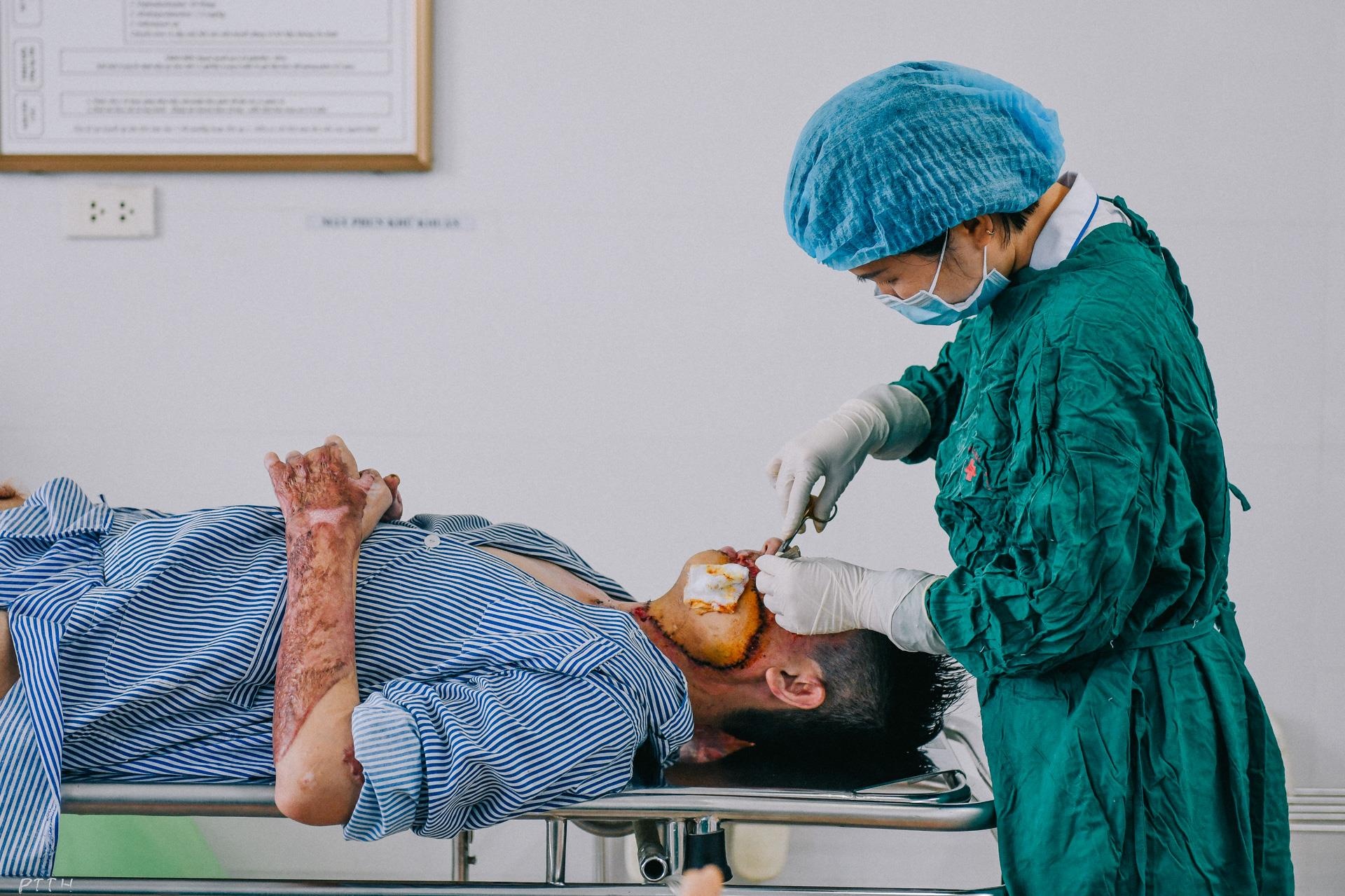 Nan nhan bi tat axit anh 29