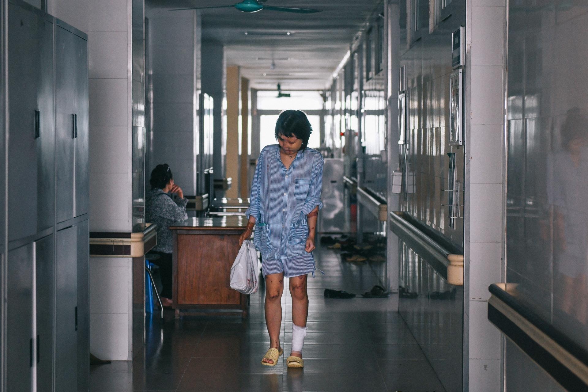 Nan nhan bi tat axit anh 32