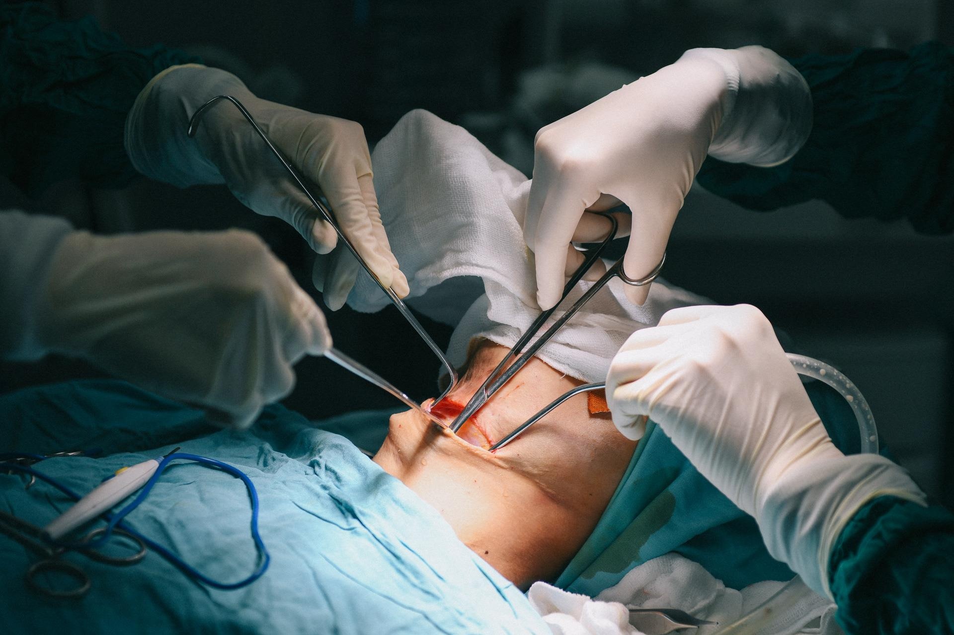 Nan nhan bi tat axit anh 26