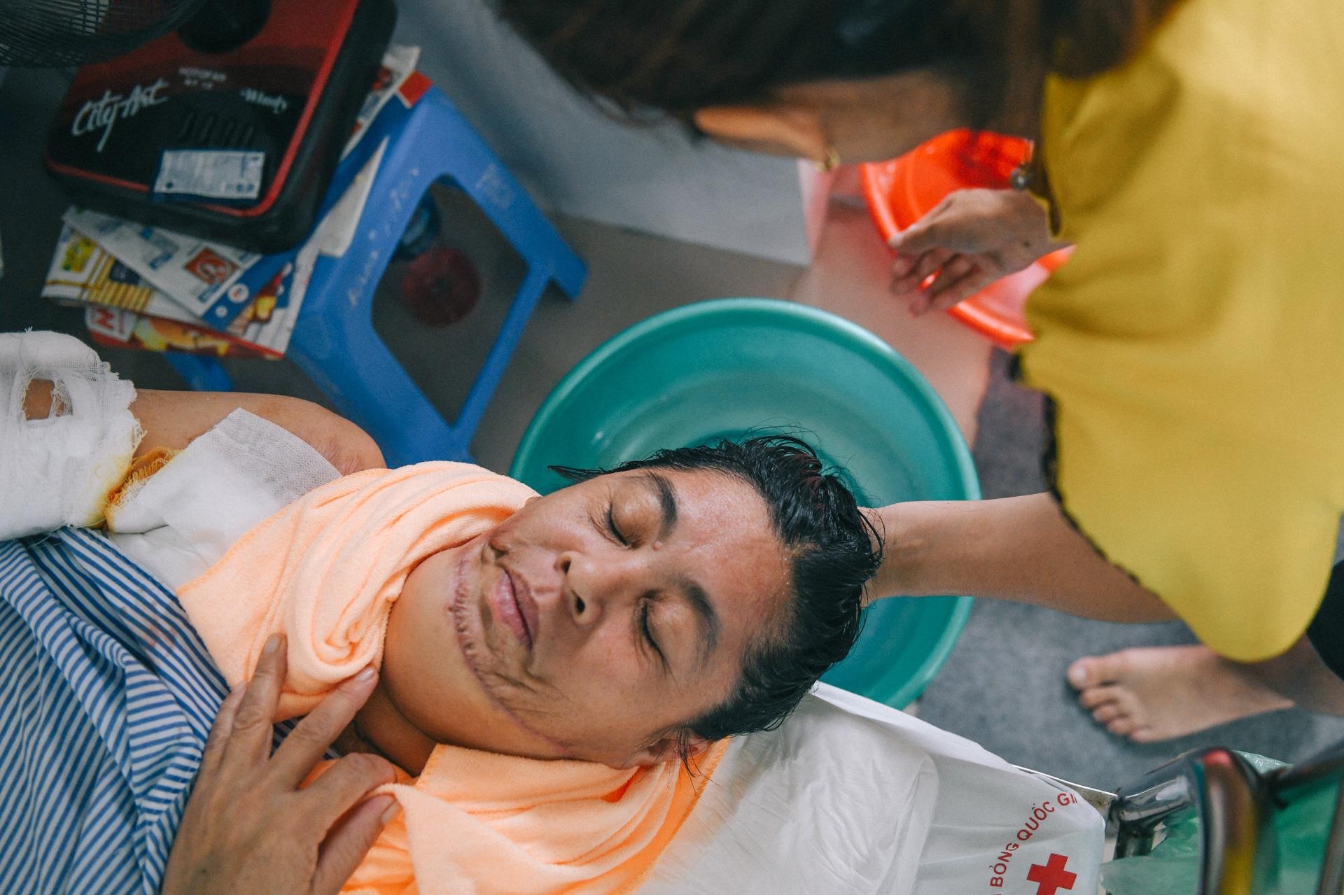 Nan nhan bi tat axit anh 20