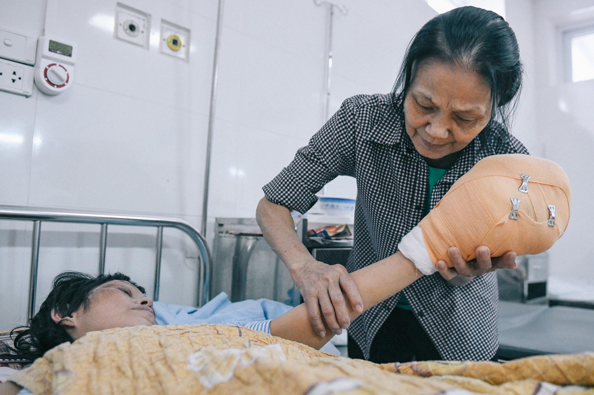 Nan nhan bi tat axit anh 13