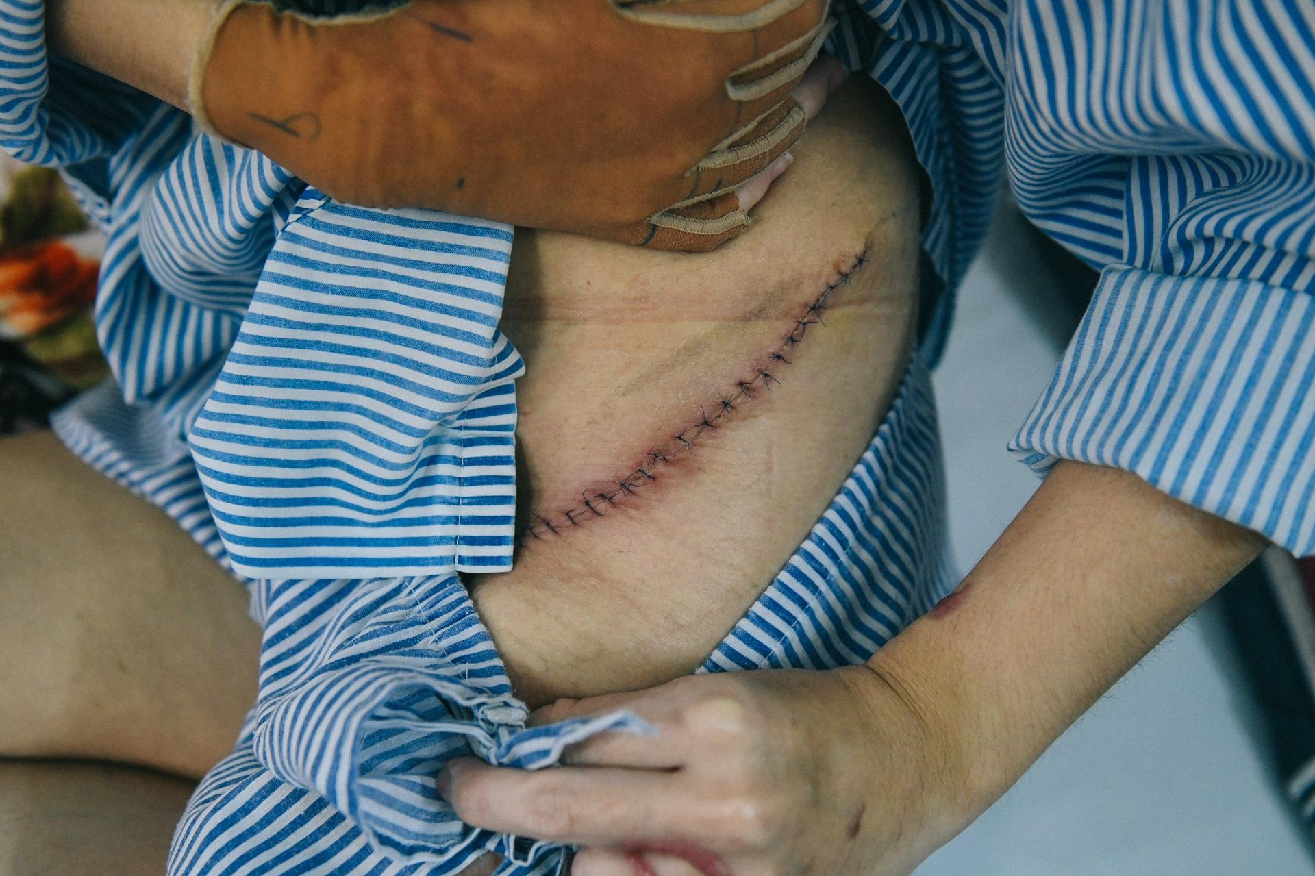 Nan nhan bi tat axit anh 5