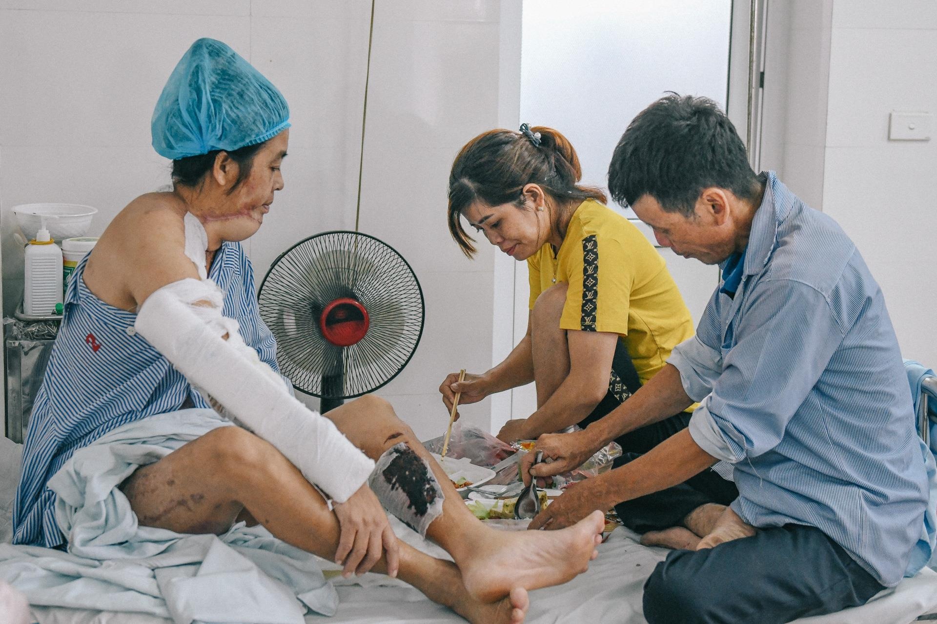 Nan nhan bi tat axit anh 21