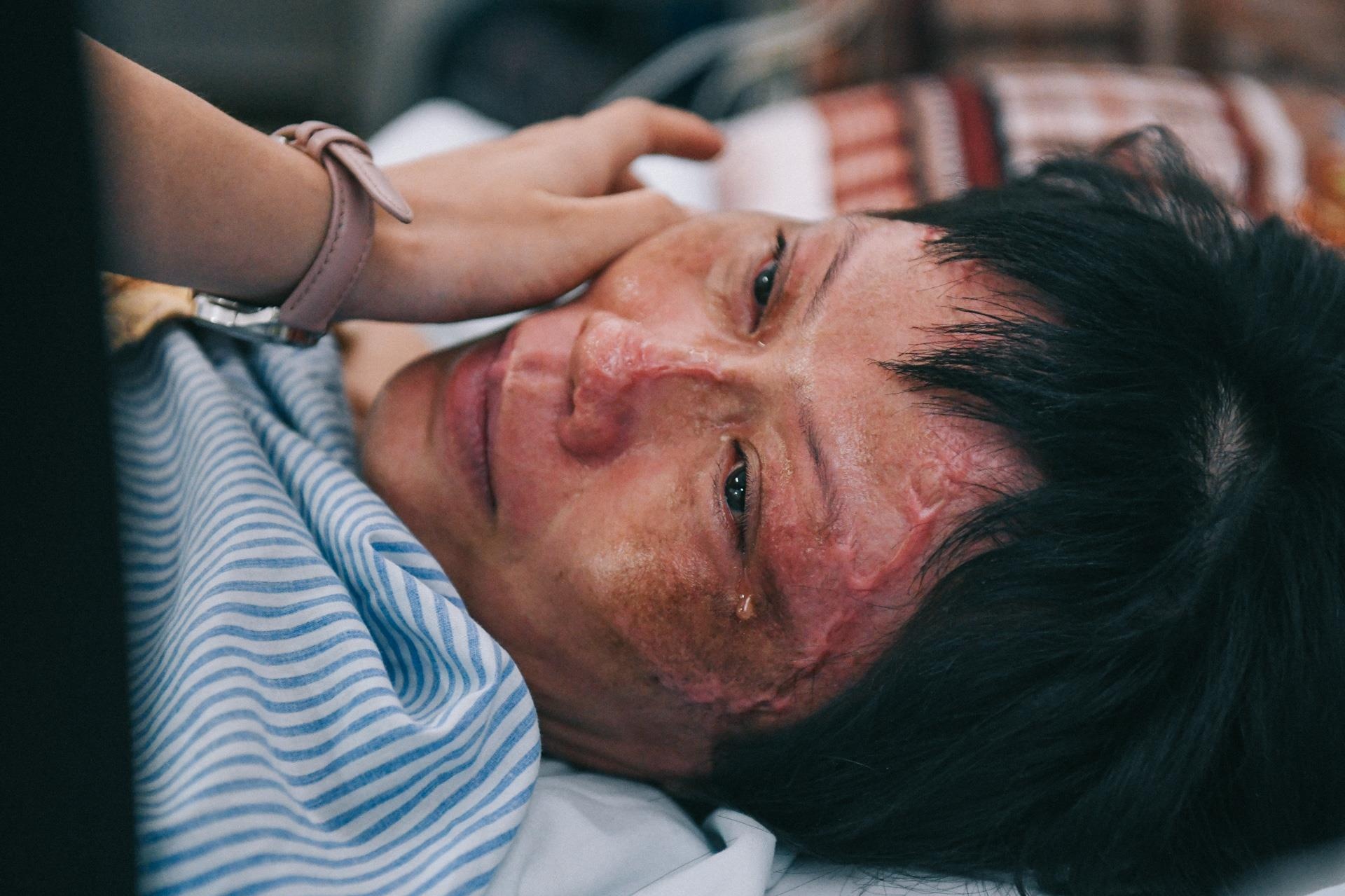 Nan nhan bi tat axit anh 24