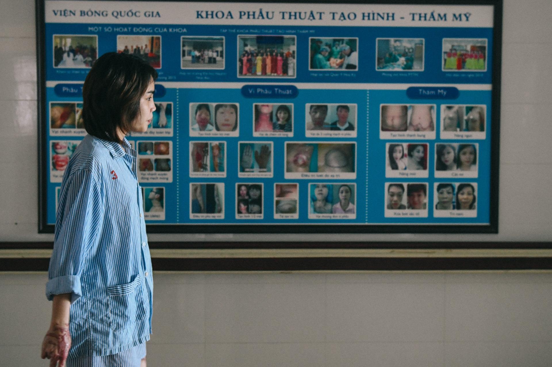 Nan nhan bi tat axit anh 3