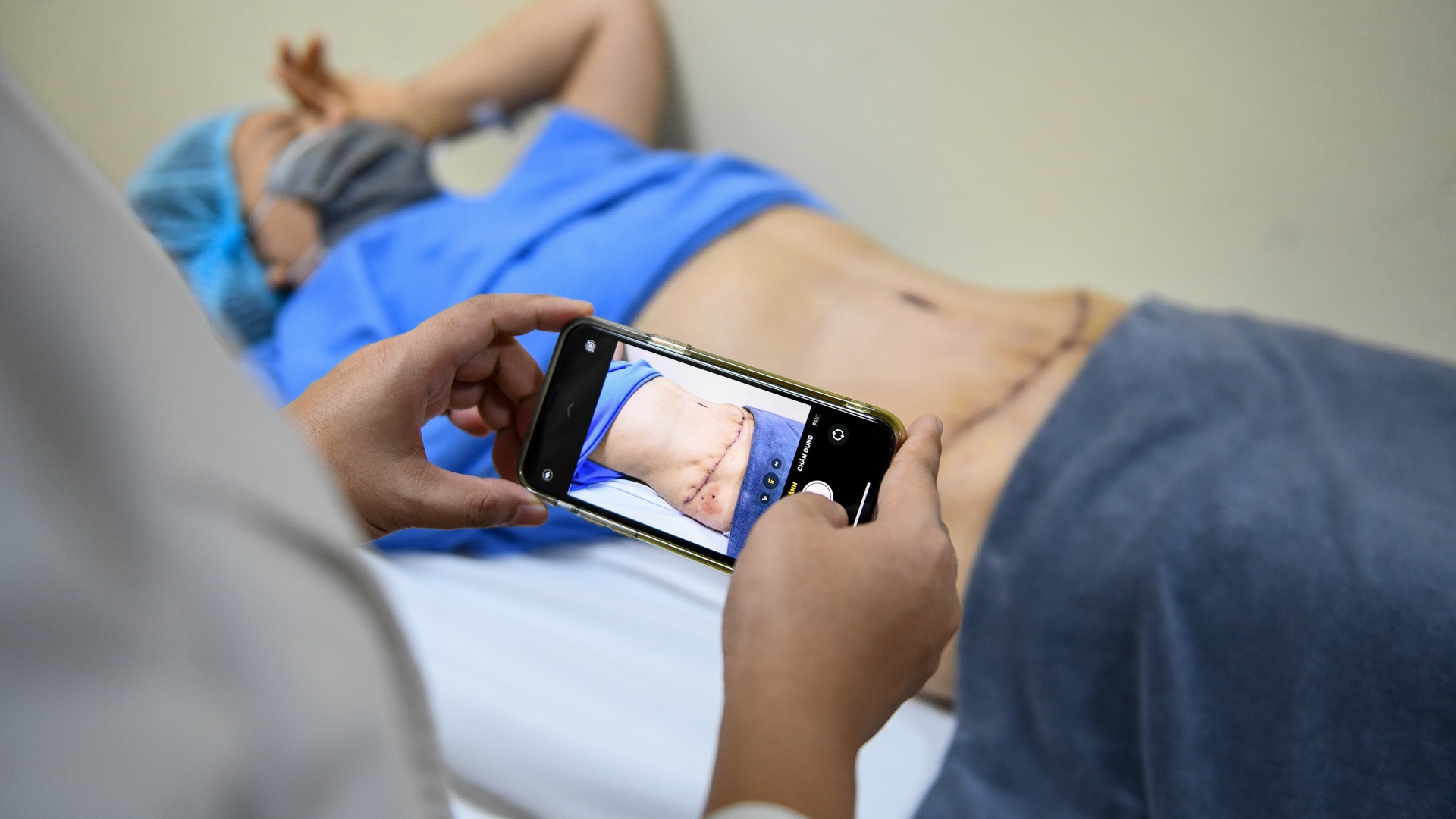 tạo hình thành bụng ảnh 20 tao hinh thanh bung anh 20