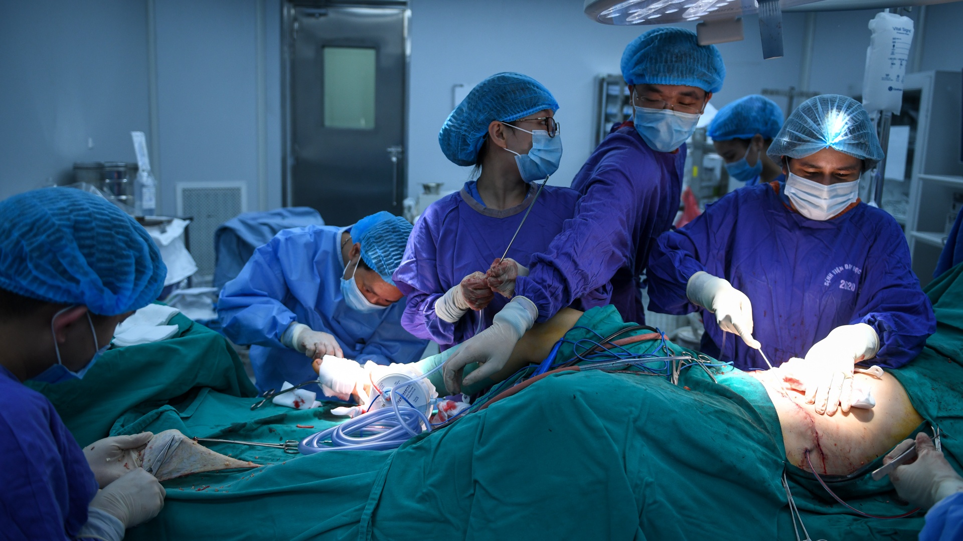 tạo hình thành bụng ảnh 7 tao hinh thanh bung anh 7