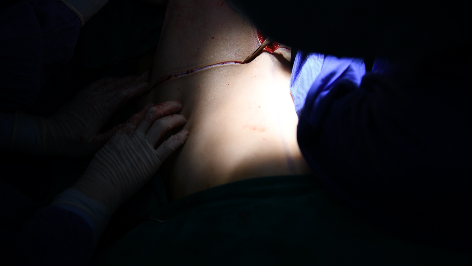 tạo hình thành bụng ảnh 13 tao hinh thanh bung anh 13