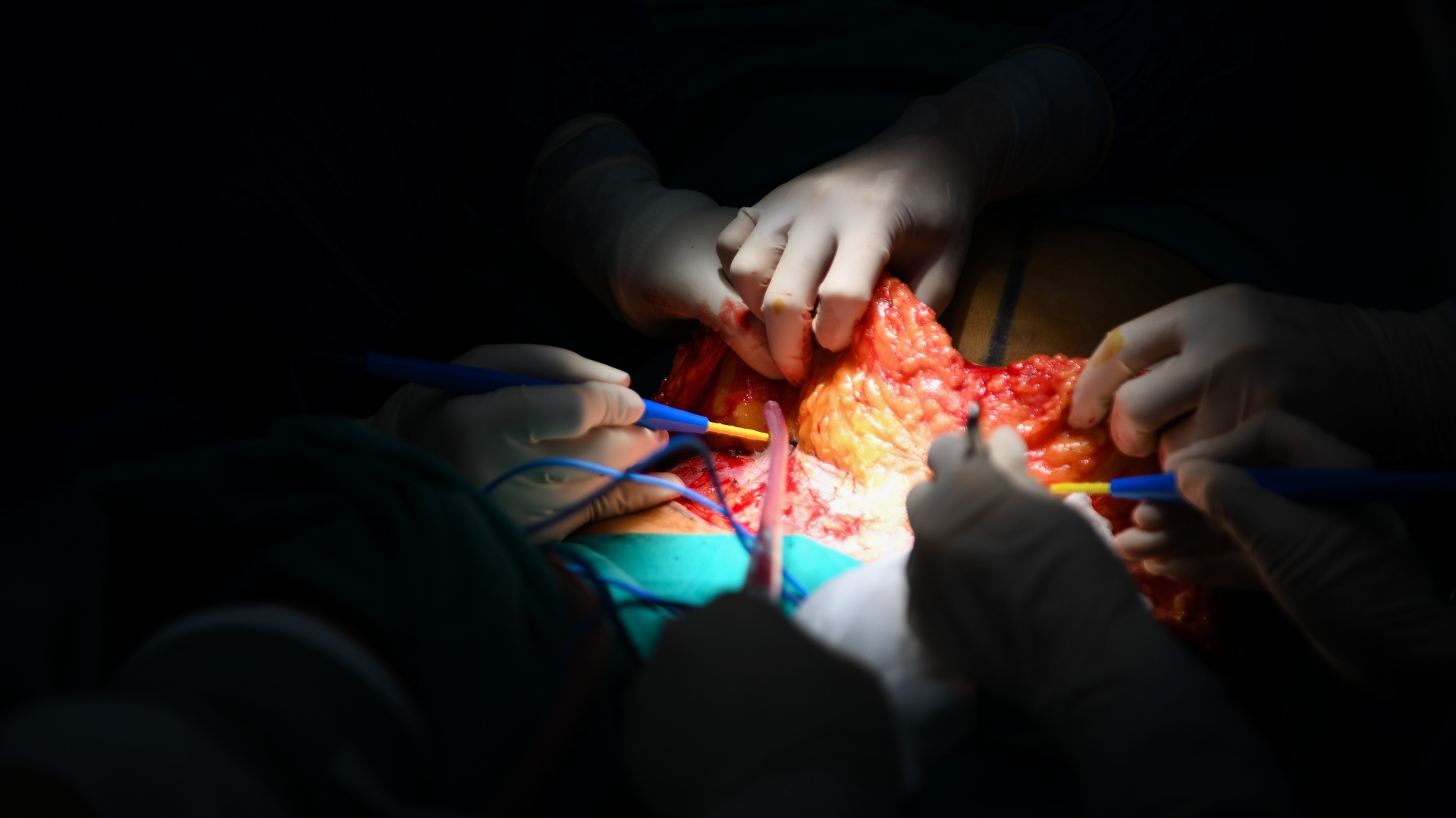 tạo hình thành bụng ảnh 10 tao hinh thanh bung anh 10