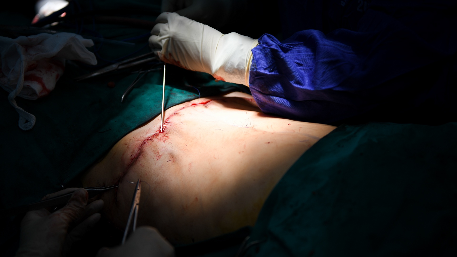 tạo hình thành bụng ảnh 15 tao hinh thanh bung anh 15