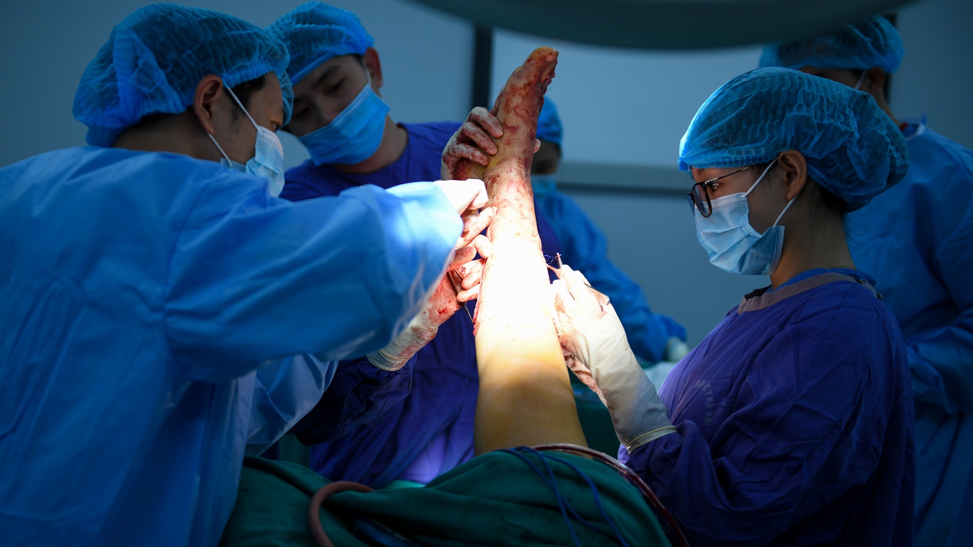 tạo hình thành bụng ảnh 16 tao hinh thanh bung anh 16