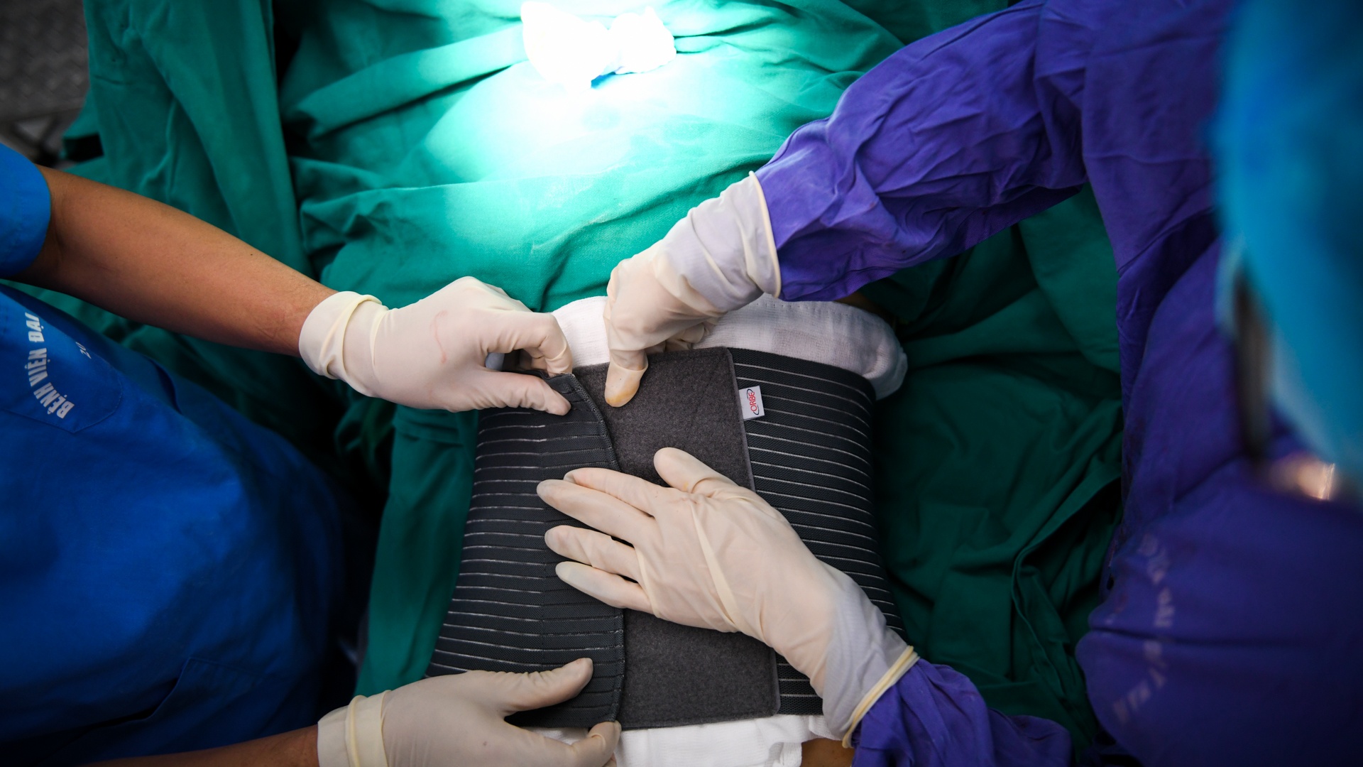 tạo hình thành bụng ảnh 18 tao hinh thanh bung anh 18