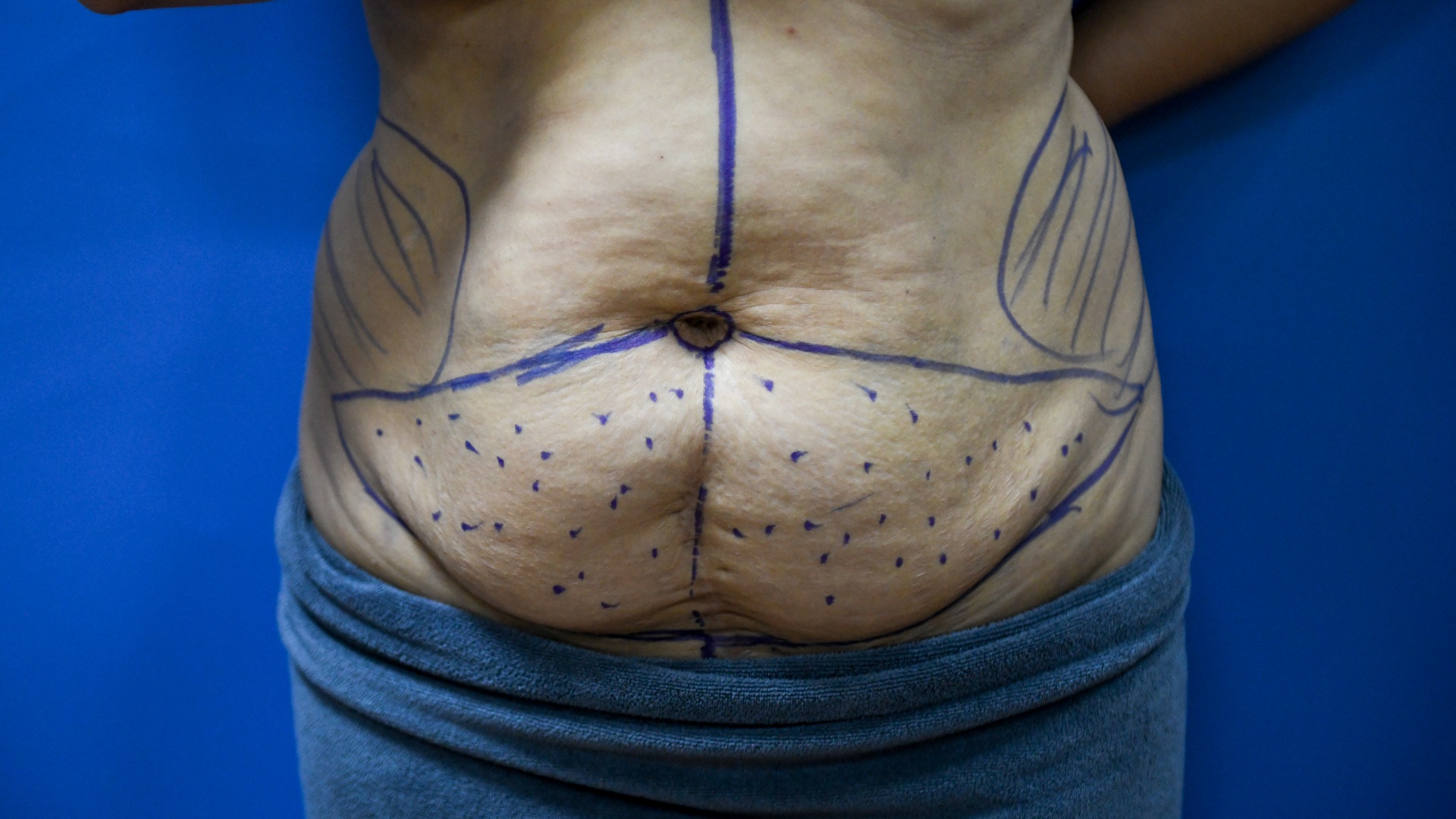 tạo hình thành bụng ảnh 4 tao hinh thanh bung anh 4