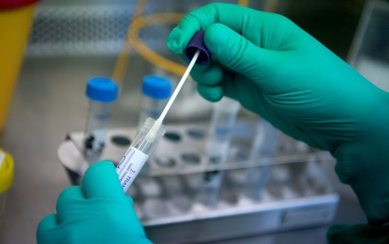 Phan ung cua cong ty nhap test 96.000-150.000 dong, ban 395.000 dong hinh anh