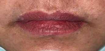 kich ung son moi anh 1