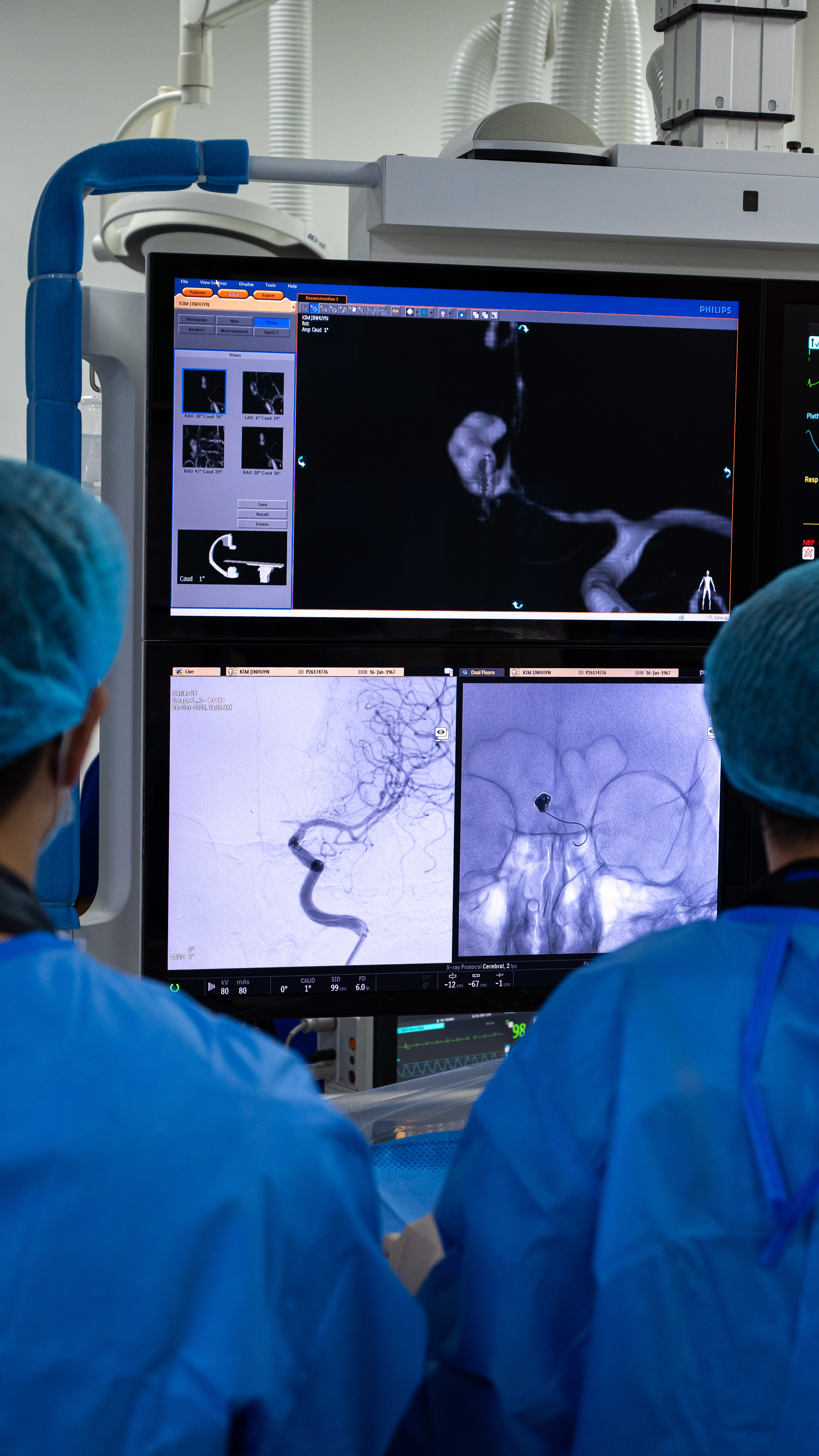 trong phong can thiep nao anh 24